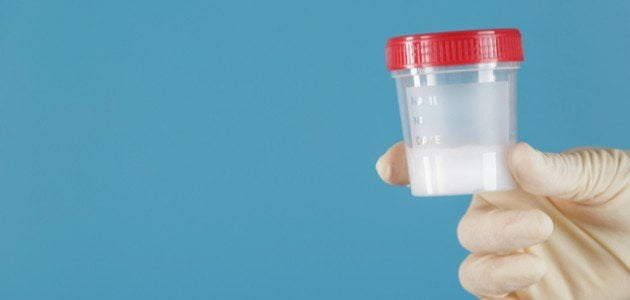 سعر تحليل سائل منوي سليم من معمل البرج 2023