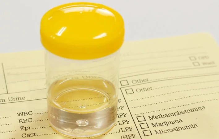 سعر تحليل مزرعة البول في جميع معامل مصر